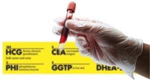 Blood sample in test tube